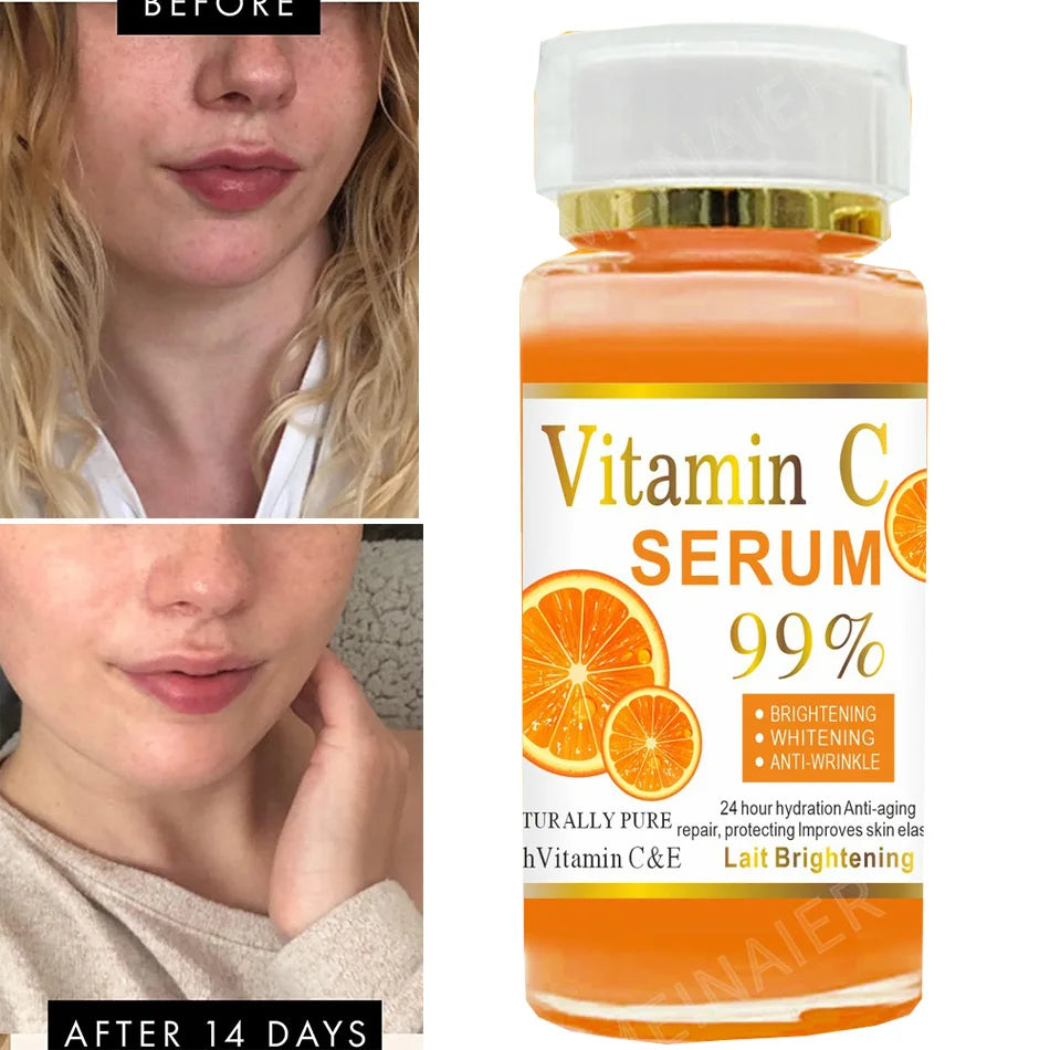 How to Reduce Pores Naturally (Simple Skincare Routine)