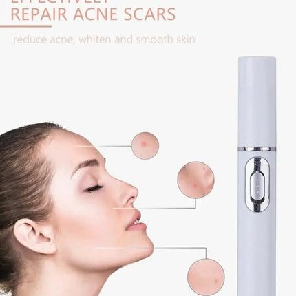 Blue Light Eye Massager — Anti Dark Circles & Puffiness Relief Tool