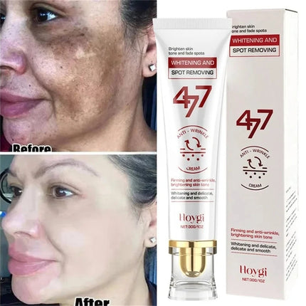 Niacinamide Brightening Cream – Dark Spot & Melasma Corrector 30ml
